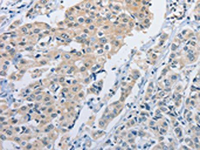NEK9 Antibody