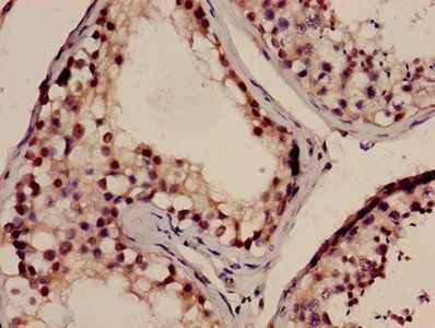 NELL2 Antibody