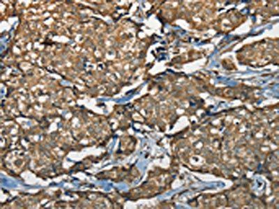 NEMF Antibody