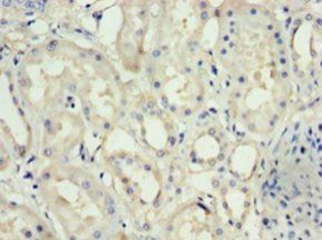 Nephrin antibody