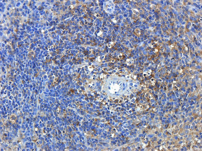 Nephrin antibody