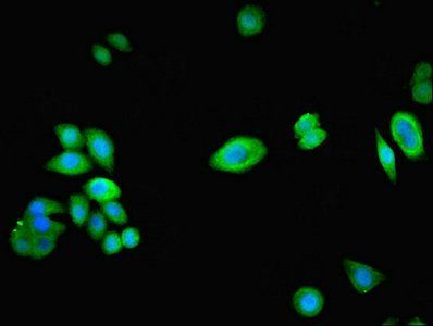 Nephrocystin-1 antibody