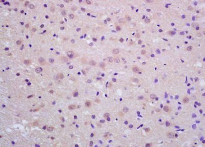 Neprilysin 2 antibody