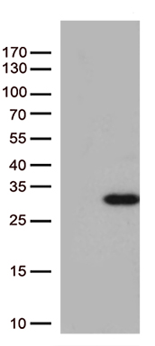 Nesprin 1 Antibody