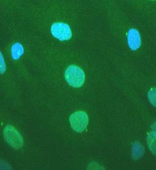 Nesprin 1 Monoclonal Antibody [MANNES1A(7A12)] - 0.1ml