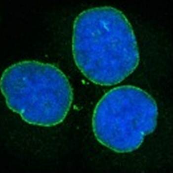 Nesprin 2 Monoclonal Antibody [K20-478-5]
