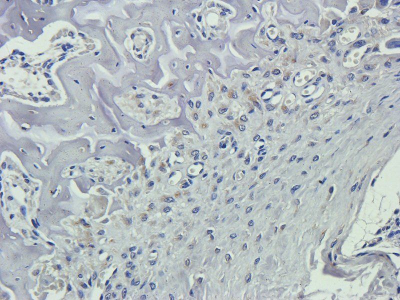 Nestin antibody