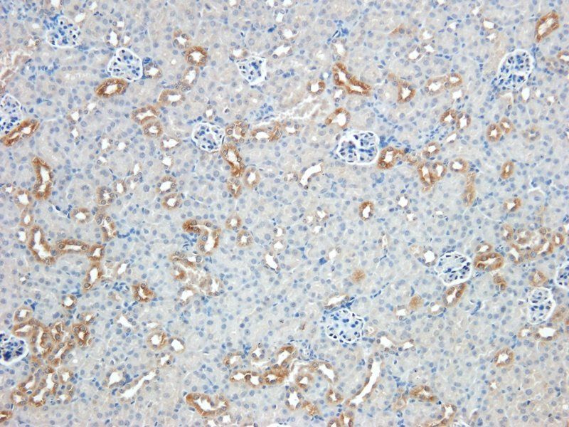 Nestin antibody