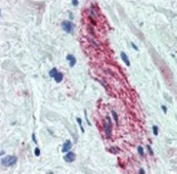 Nestin Monoclonal Antibody [10C2] (also known as 2C1.3A11) - Neural Stem Cell Marker - Unconjugated / 0.1ml