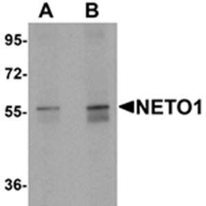 NETO1 Antibody