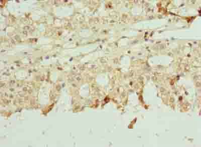 NETO2 Antibody