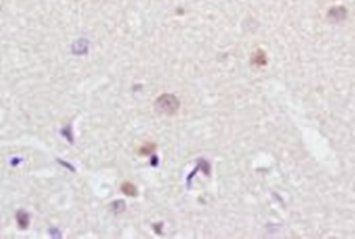 NeuroD1 antibody