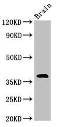 NEUROD6 Antibody