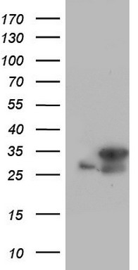 Neurofilament (NEFL) antibody