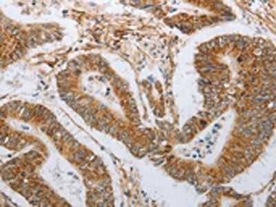 NEUROG1 antibody