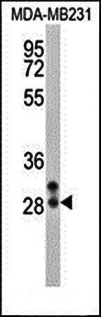 NEUROG2 antibody