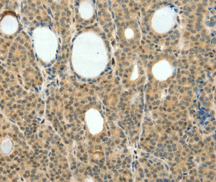 NEUROG3 Antibody