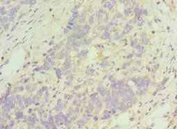 TACR3 Antibody