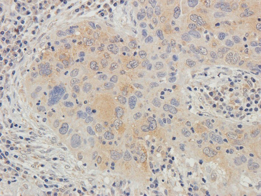 Neuroplastin antibody