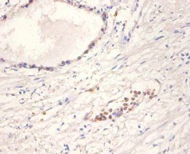 Neurotrophin-4 antibody