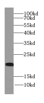 neurturin-Specific antibody