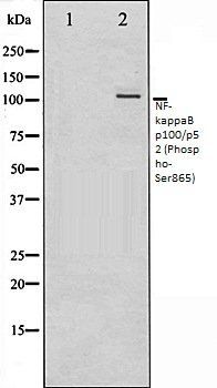 NF-kappaB p100/p52 (Phospho-Ser865) antibody