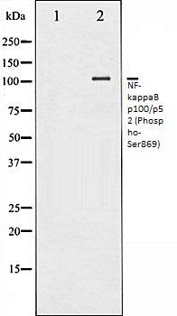 NF-kappaB p100/p52 (Phospho-Ser869) antibody