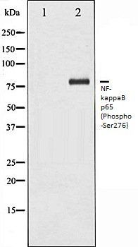 NFkB p65 (Phospho-Ser276) antibody