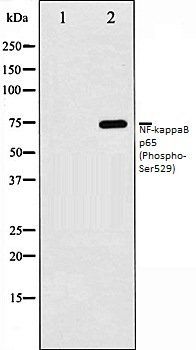NFkB p65 (Phospho-Ser529) antibody