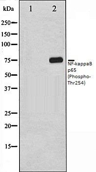 NFkB p65 (Phospho-Thr254) antibody