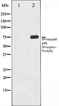 NFkB p65 (Phospho-Thr435) antibody