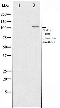 NF-kB p100 (Phospho-Ser872) antibody