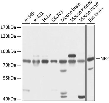 NF2 antibody
