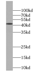NF45 antibody