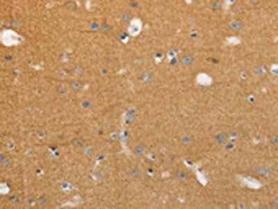 NFASC Antibody