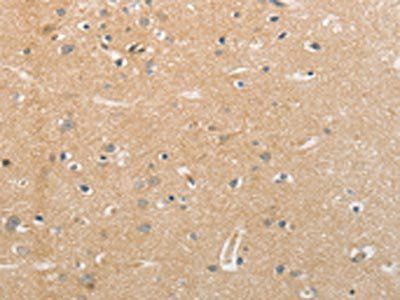 NFASC Antibody