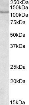 Goat anti-NFATC2 / NFAT1 Antibody