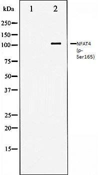 NFAT4 (phospho-Ser165) antibody
