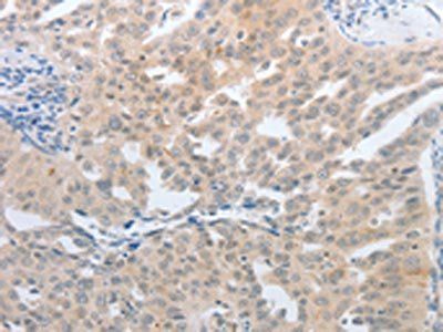 NFAT5 antibody