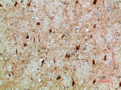 NFAT5 Antibody