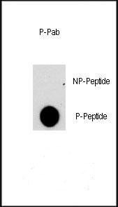 NFATC2 (phospho-Ser330) antibody