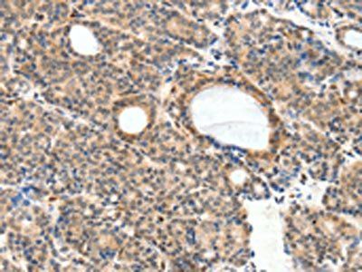 NFATC2 Antibody