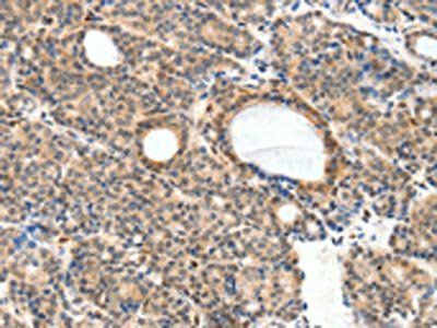 NFATC2 antibody