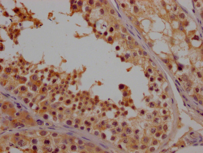 NFATC2 Antibody