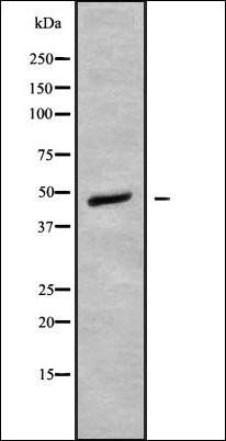 NFATc2IP antibody