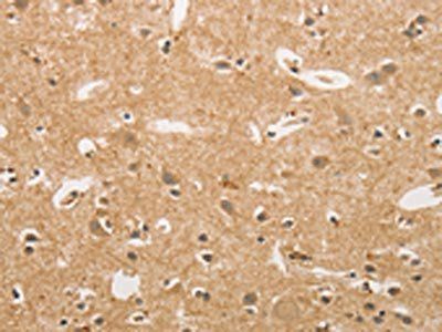 NFE2L1 Antibody