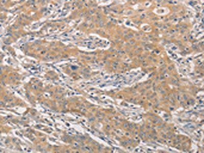 NFE2L1 Antibody