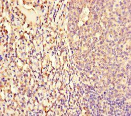 NFIX Antibody