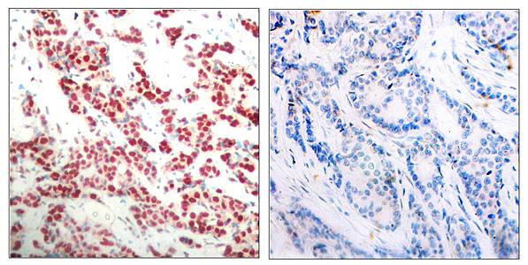 NFκB-p100/p52(Phospho-Ser866) Antibody