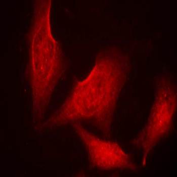 NFκB-p65((phospho-Ser311) Antibody